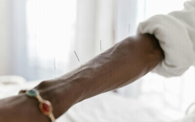 Acupuncture for Pain Relief: How Tiny Needles Can Make a Big Difference