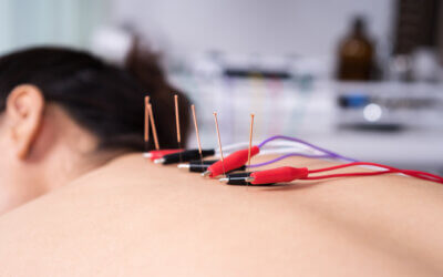 Electroacupuncture for Chronic Pain, Muscle Recovery, and Nerve Recovery