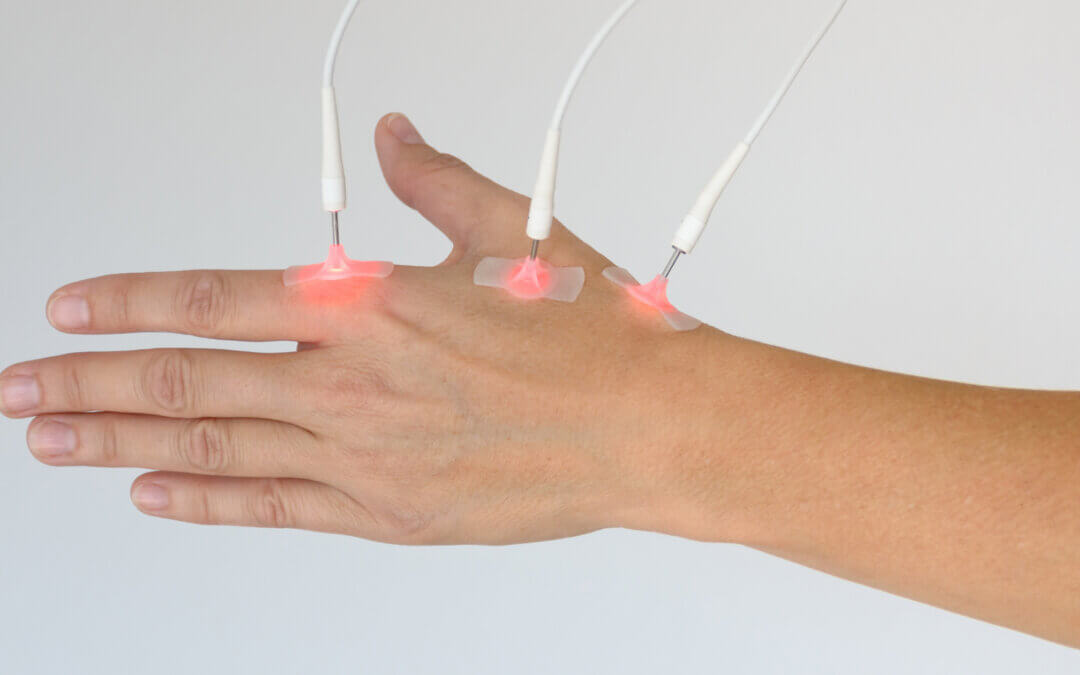 Photobiomodulation + Acupuncture: A Modern Approach to Pain Relief