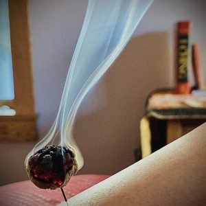 moxibustion treatment